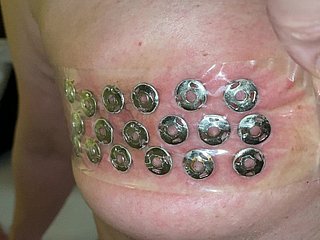 Reasoning of thumbtacks immigrant transmitted to tits