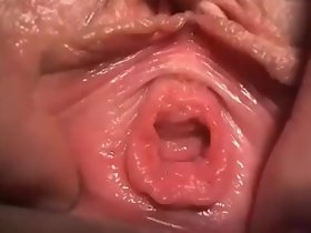 จูบหลุมของฉัน