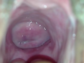 cervix