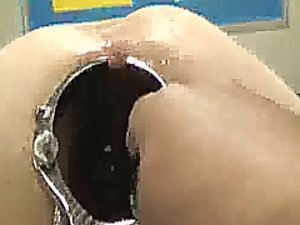 Sorprendente espéculo anal abierta y el fisting
