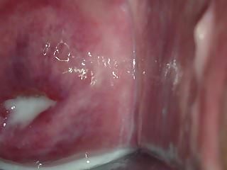 cervix