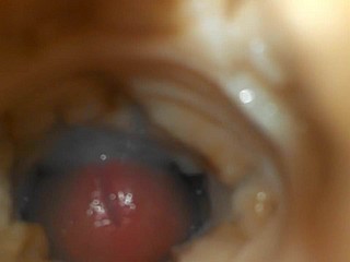 Cumming Medial My Toy.